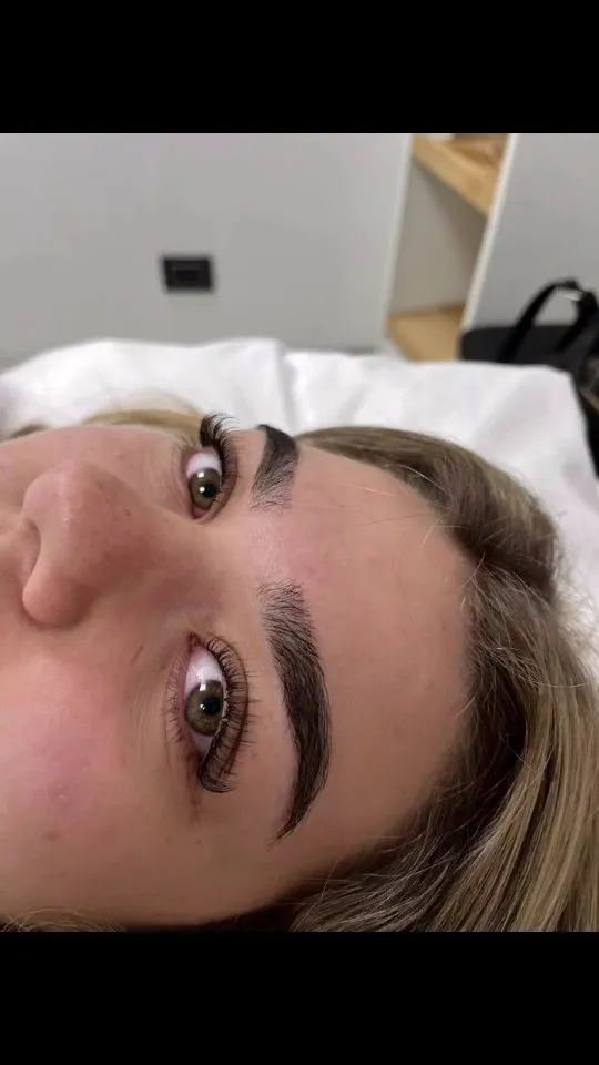 Limpieza facial premiun con crioradiofrecuencia 